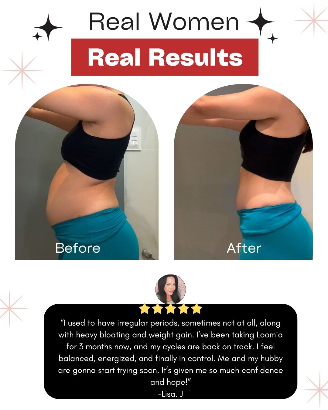 LOOMIA® Cranberry Probiotic Gummies