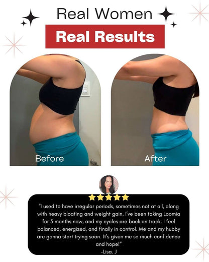 LOOMIA® Cranberry Probiotic Gummies